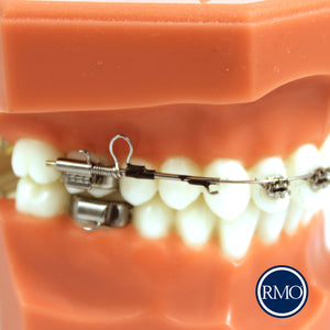 RMO ARCO BIMÉTRICO DISTALIZADOR MAXILAR 3D®