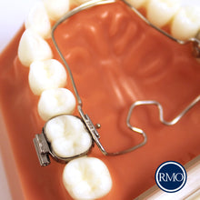 Cargar imagen en el visor de la galería, RMO ARCO PALATAL MULTI-ACCIÓN 3D®