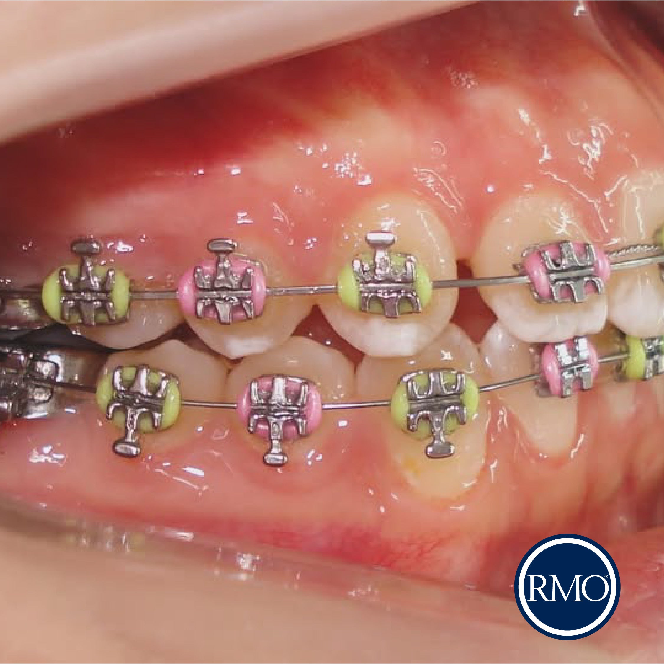 RMO BRACKET SYNERGY BAJA FRICCIÓN